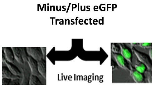 WT eGFP gene imaged in HeLa cells.